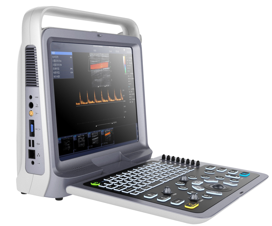 P60 Portable Color Doppler Ultrasound Diagnostic System