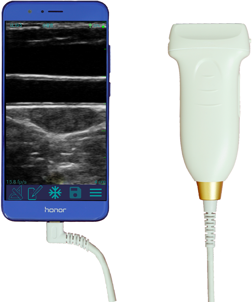 U6 Color Doppler Ultrasound Diagnostic System