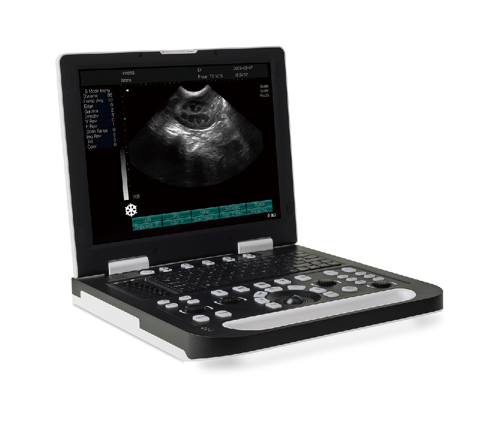 RS-N50(VET) Full-Digital Laptop Ultrasound System