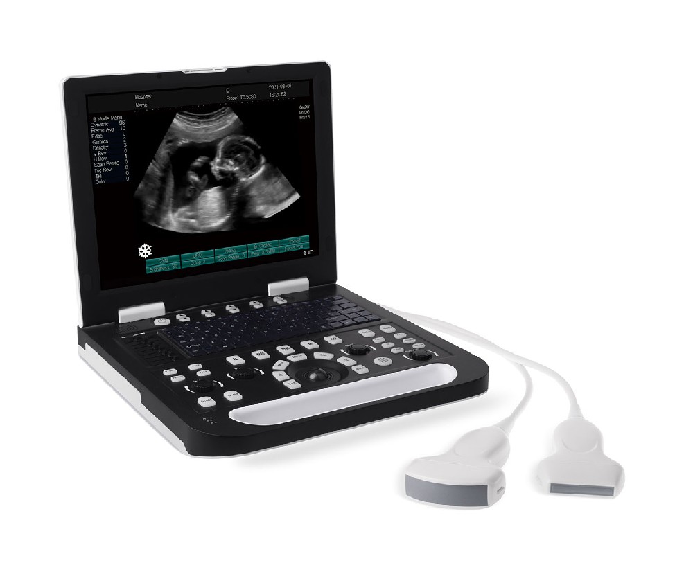 RS-N50  B/W Full-Digital Laptop Ultrasound System