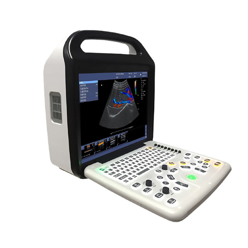 P50  PORTABLE COLOR DOPPLER ULTRASOUND SCANNER